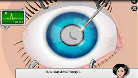 眼睛手术中文版 手术没开始就出事故了