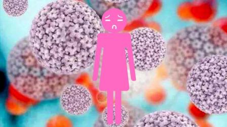 全球女性都是宫颈癌潜在患者, 3分钟科普带你预防HPV病毒