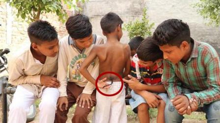 印度8岁小男孩长有尾巴, 被信徒当做“猴神”转世, 天天想来摸!