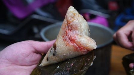 什么是肝癌的介入治疗