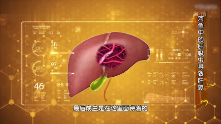 什么是肝癌的介入治疗