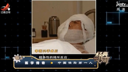 男子成为中国第一例成功换脸之人，手术后向医生提要求，却被拒绝