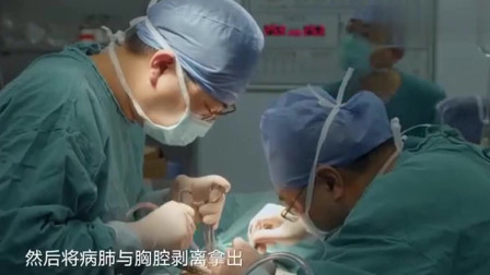 人世间：实录开胸手术的真实过程，病人真的是九一生