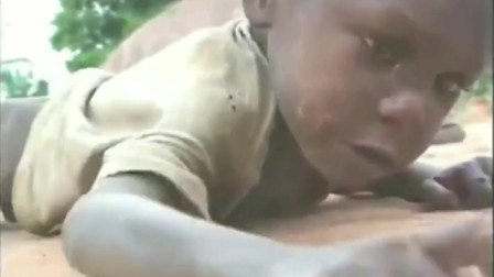 非洲饥荒, 4岁孩童被活活饿晕, 心痛!