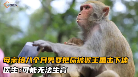 母亲给八个月男婴把尿，结果被猴王重击下体，医生：可能无法生育