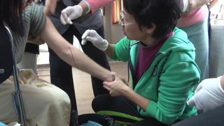 四缝针刺放血疗法视频,董氏放血疗法视频