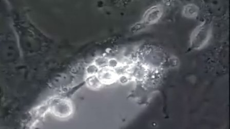 [道兰][NHK纪录片]人体DNA时代（4）：生命时钟之谜
