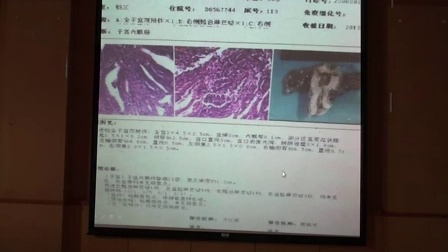 2014年南昌大学第一附属医院超声造影学习班05