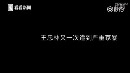 男性家暴受害者自述-妻子把我推下楼_标清