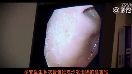 恐怖！女子狂吃海棉20年_标清