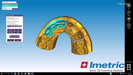 Imetric 3D 扫描仪 bridge mirror 和 exocad 设计软件 CAD