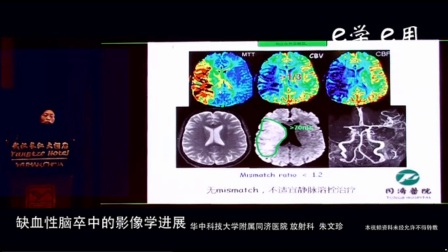 13、2017GE磁共振临床应用技术培训班（武汉站）缺血性脑卒中的影像学进展
