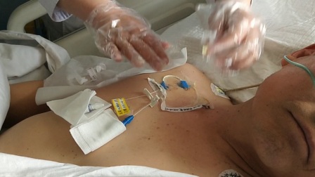 曲沃县人民医院 更换中心静脉导管贴膜