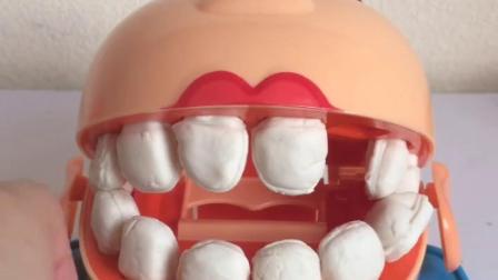 大嘴缺了一颗牙齿，用膜具做一颗牙齿给大嘴来把牙齿镶上吧