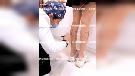 杭州美莱美容医院可靠吗？注射瘦腿针前的设计。